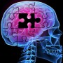 The effects of Alzheimer's on our brain