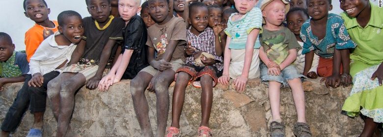 Albino Tribe Butchered for Black Magic Medicine