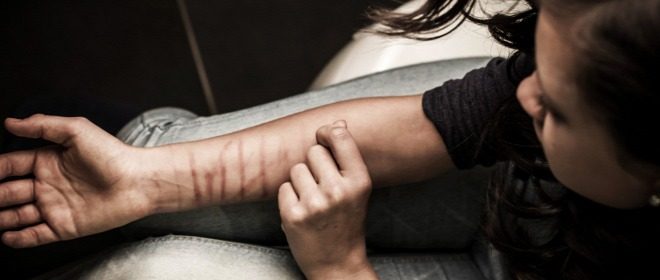 Self-harm in Girls and Young Women