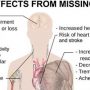 Sleep Deprivation and Your Heart